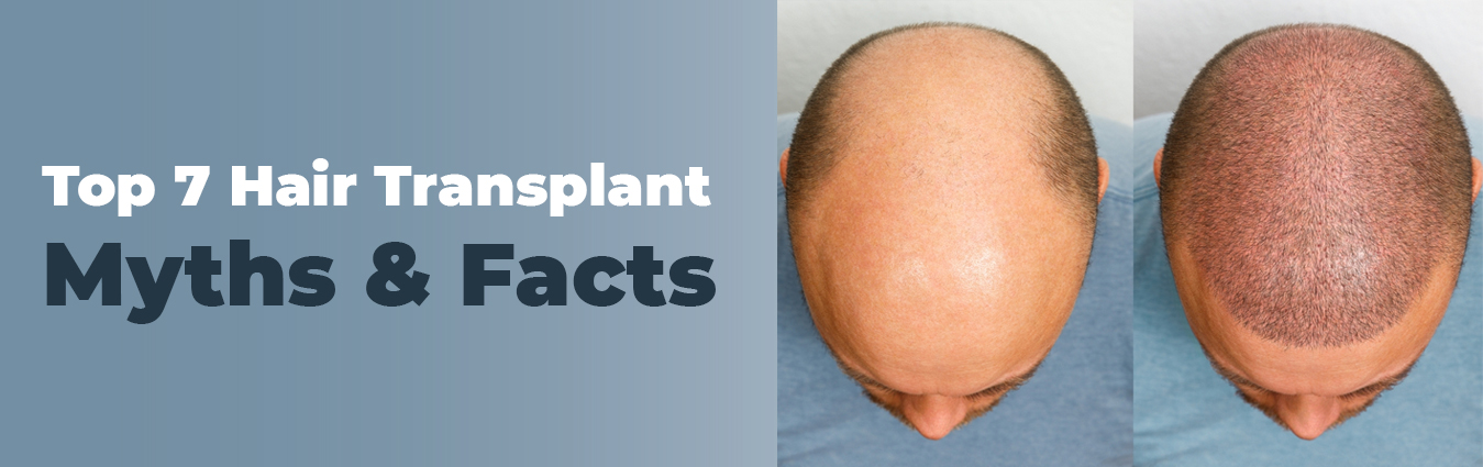 Top Hair Transplant Myths And Facts Dr Paul Online