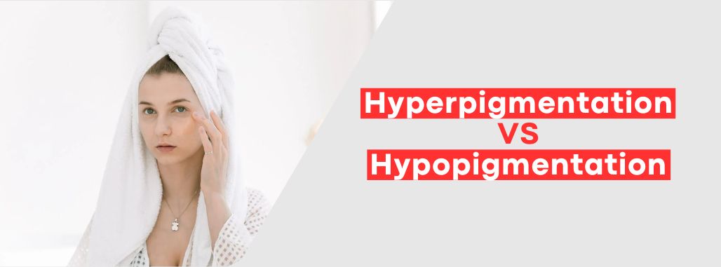 Hyperpigmentation Vs Hypopigmentation What Should You Know