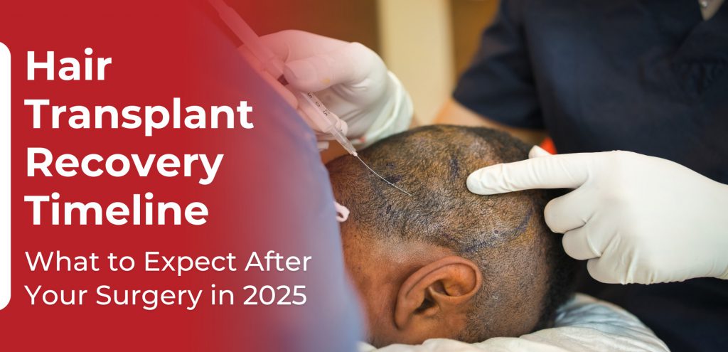 Hair Transplant Recovery Timeline – What to Expect After Your Surgery ...